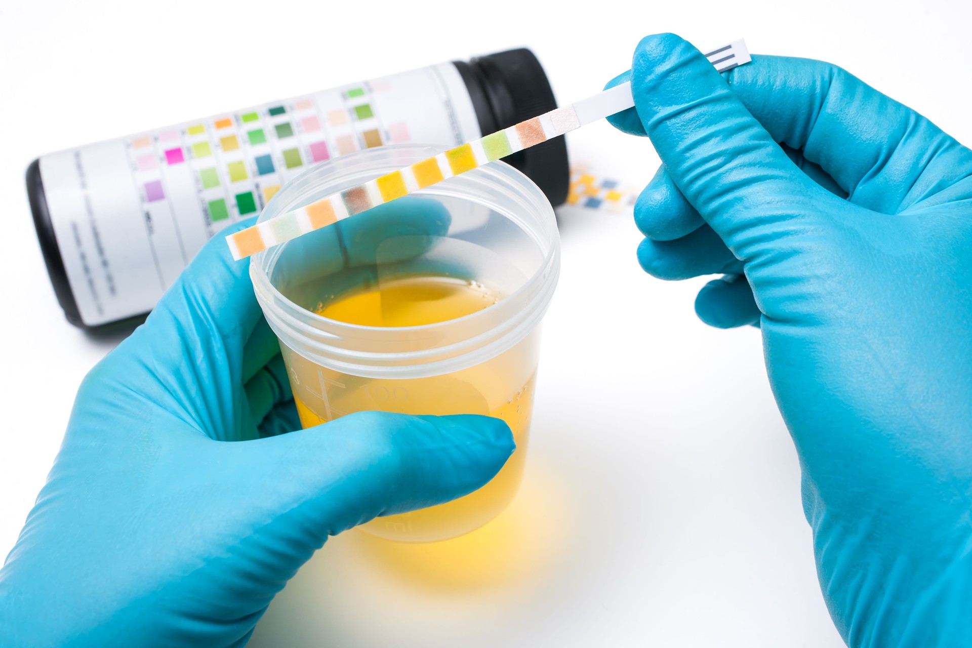 Certified collector sealing urine specimen for Non-DOT drug test at EverNine Diagnostics.